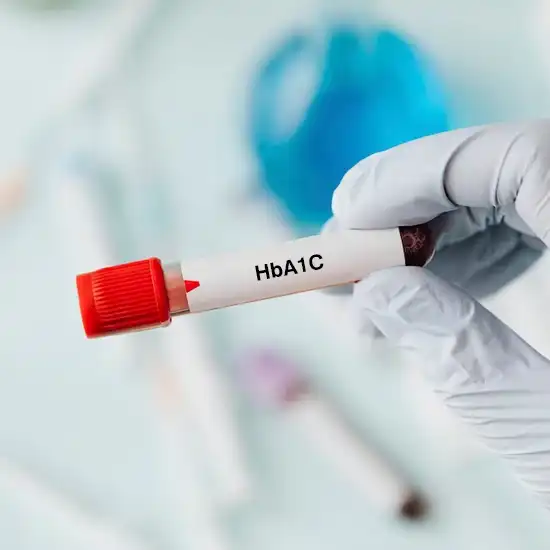 book hba1c test at home test